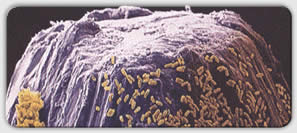 Bakterier på spissen av en nål 
